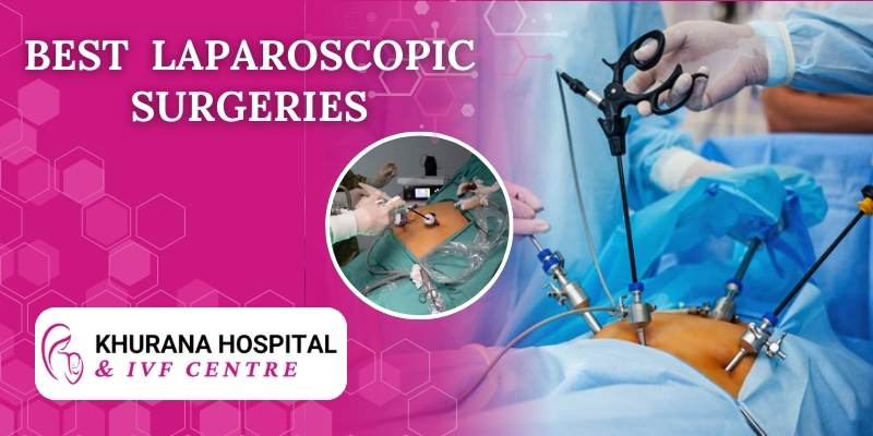 Laparoscopic Surgeries