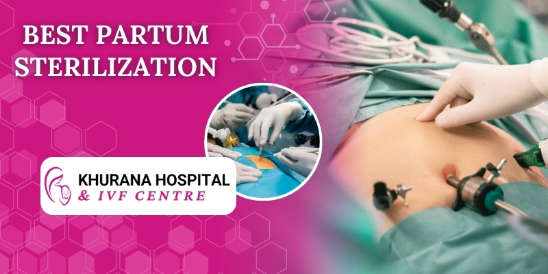 partum-sterilization